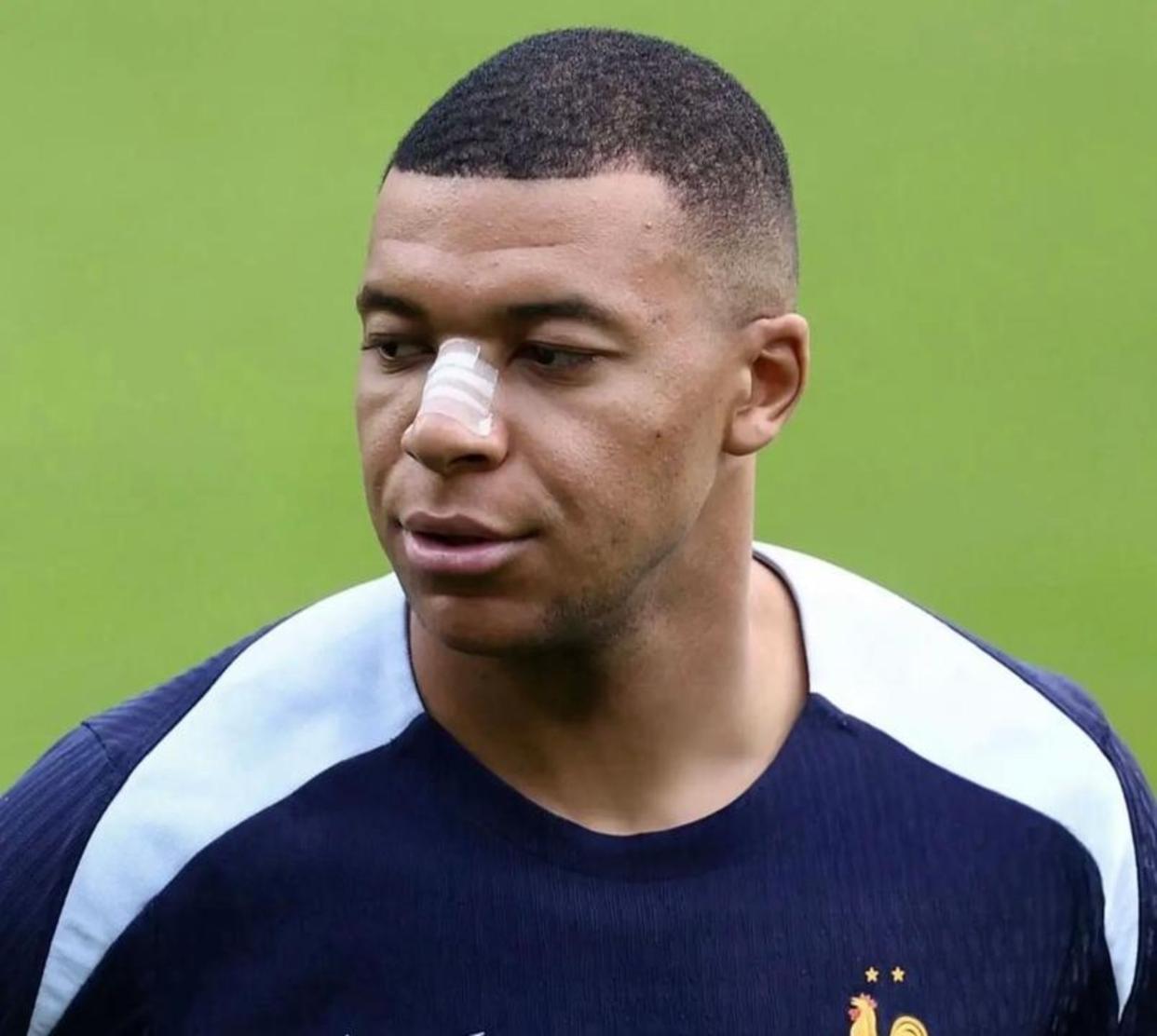 姆巴佩在MAD比赛中关键助攻，赛事规则更新引发热议！的简单介绍